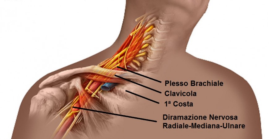 Che cos'è il Plesso brachiale Dr. Felici