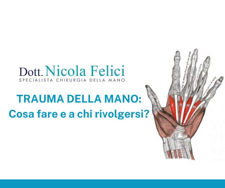 Trauma della mano - Dr Felici