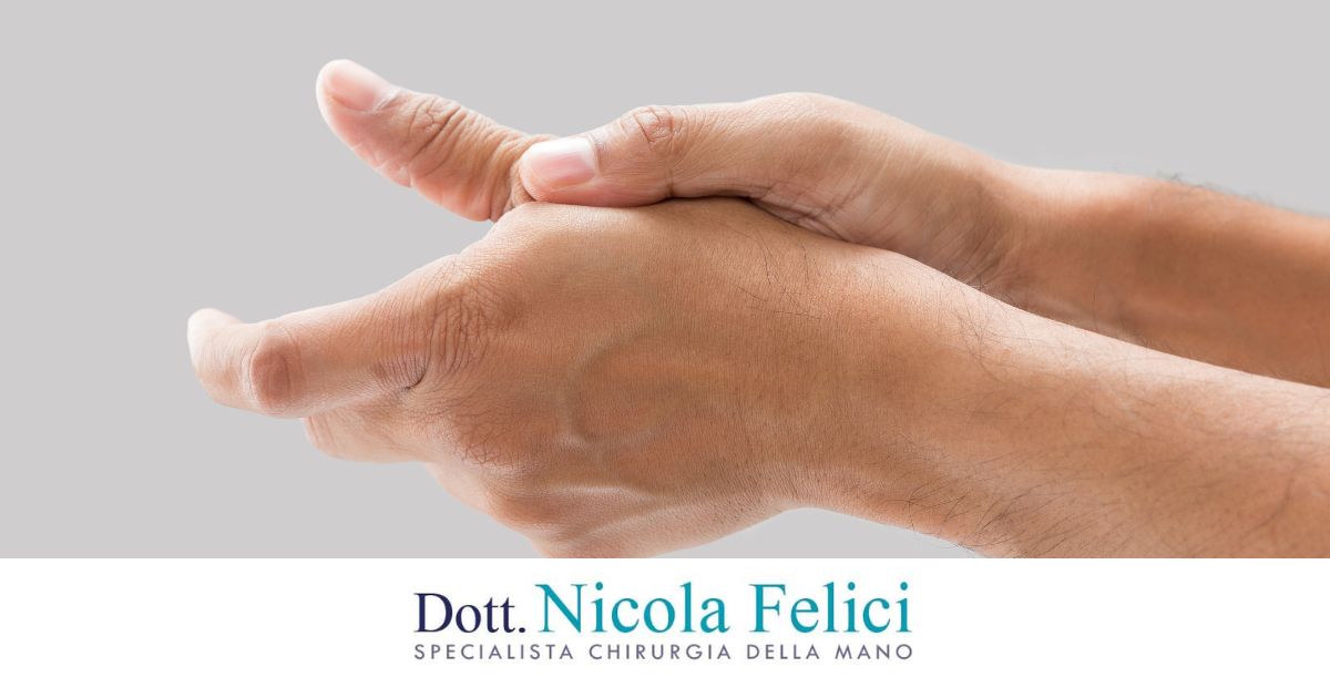 Rizoartrosi cos'è, quali sono i sintomi e come si cura - Dr. Felici