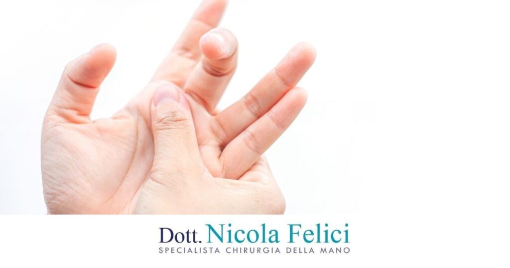 Dito a scatto cosa fare e quando serve l’intervento chirurgico - Dr. Nicola Felici