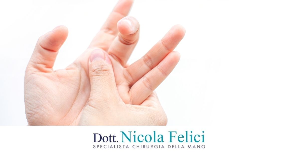 Dito a scatto cosa fare e quando serve l’intervento chirurgico - Dr. Nicola Felici
